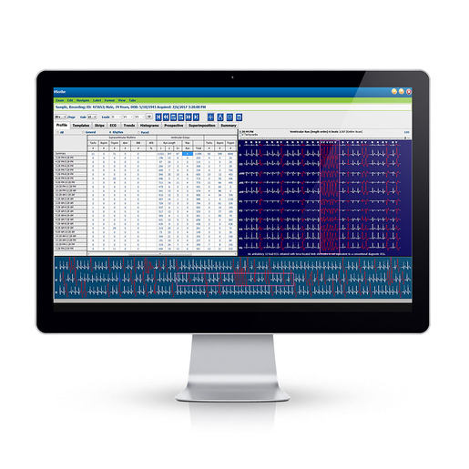 HScribe™ Holter Analysis System HScribe™ Holter Analysis System