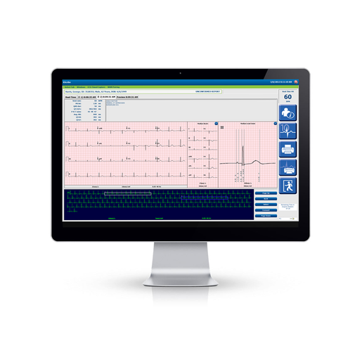 RScribe™ Resting ECG System RScribe™ Resting ECG System